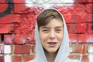 What Is The Average Cost Of Braces? average cost of braces riverside ct