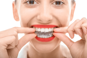 Invisalign Rye, NY