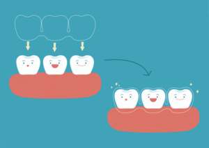 How to Decide if Invisalign is Right For You near Darien, CT