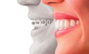 orthodontist-byram-ct