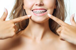 Braces Darien CT