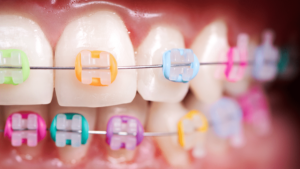 Orthodontics