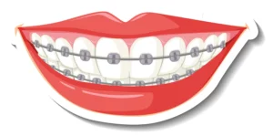 Braces in Greenwich Ct