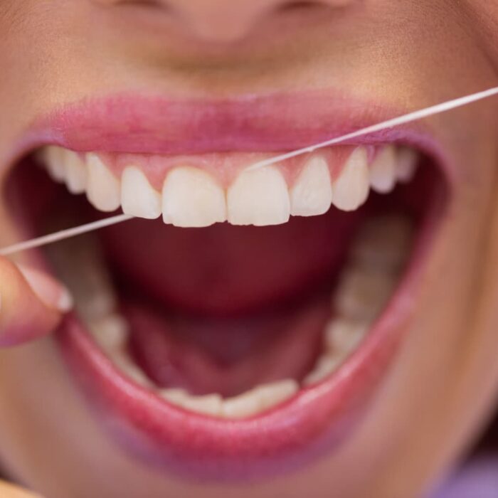 why you should floss