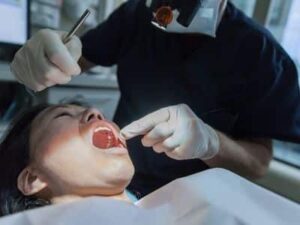 After Jaw Surgery