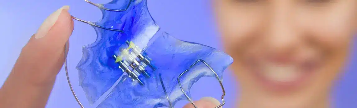 Orthodontic Appliances | Riverside Orthodontics