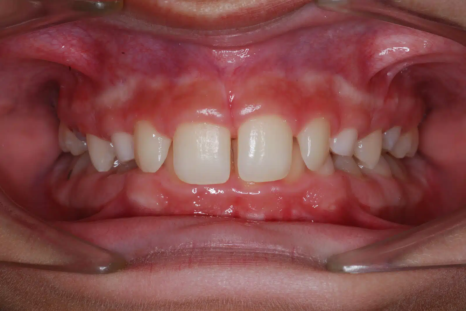 CDG 2 pretx CDG 2 pretx