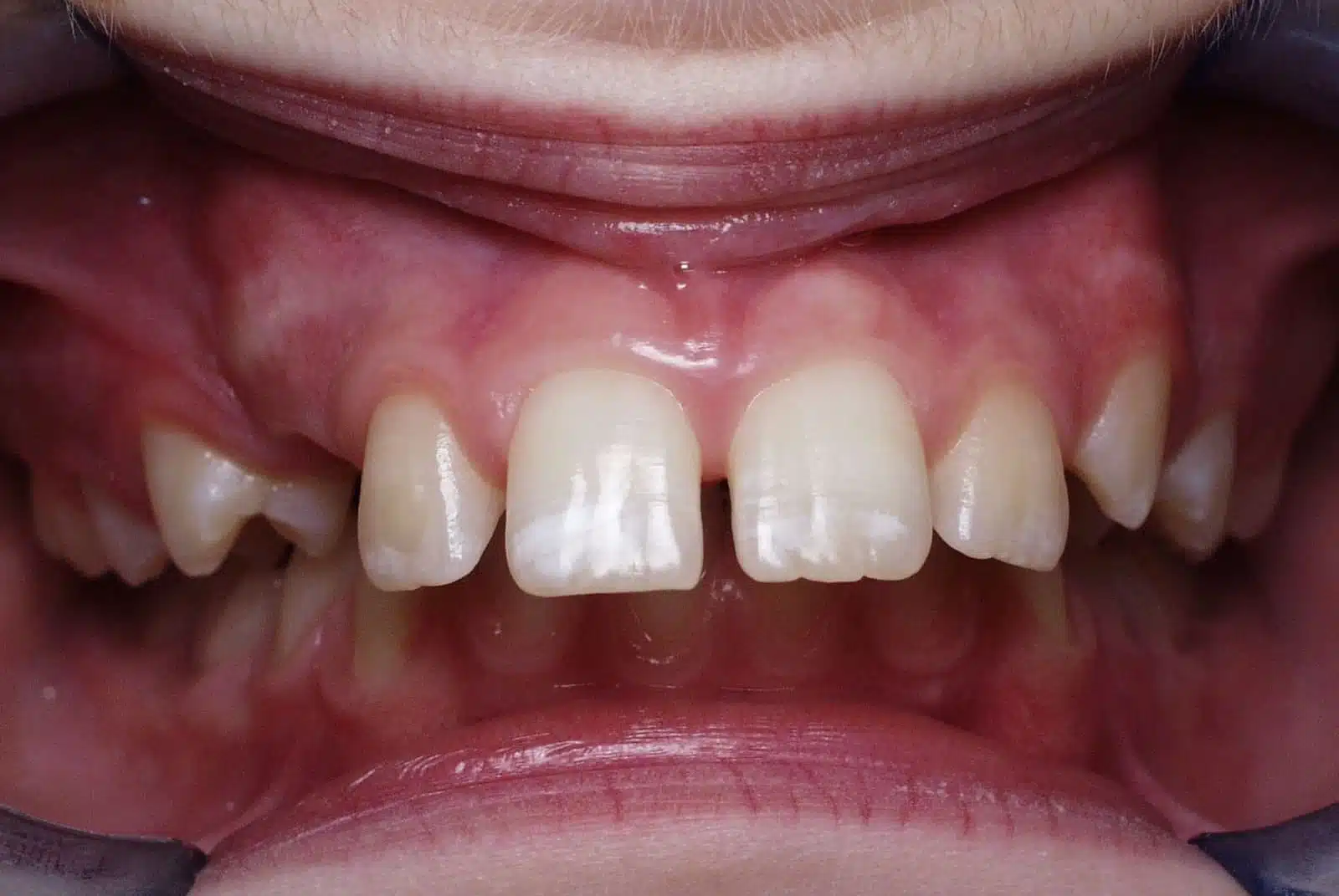 CG 2 pretx CG 2 pretx