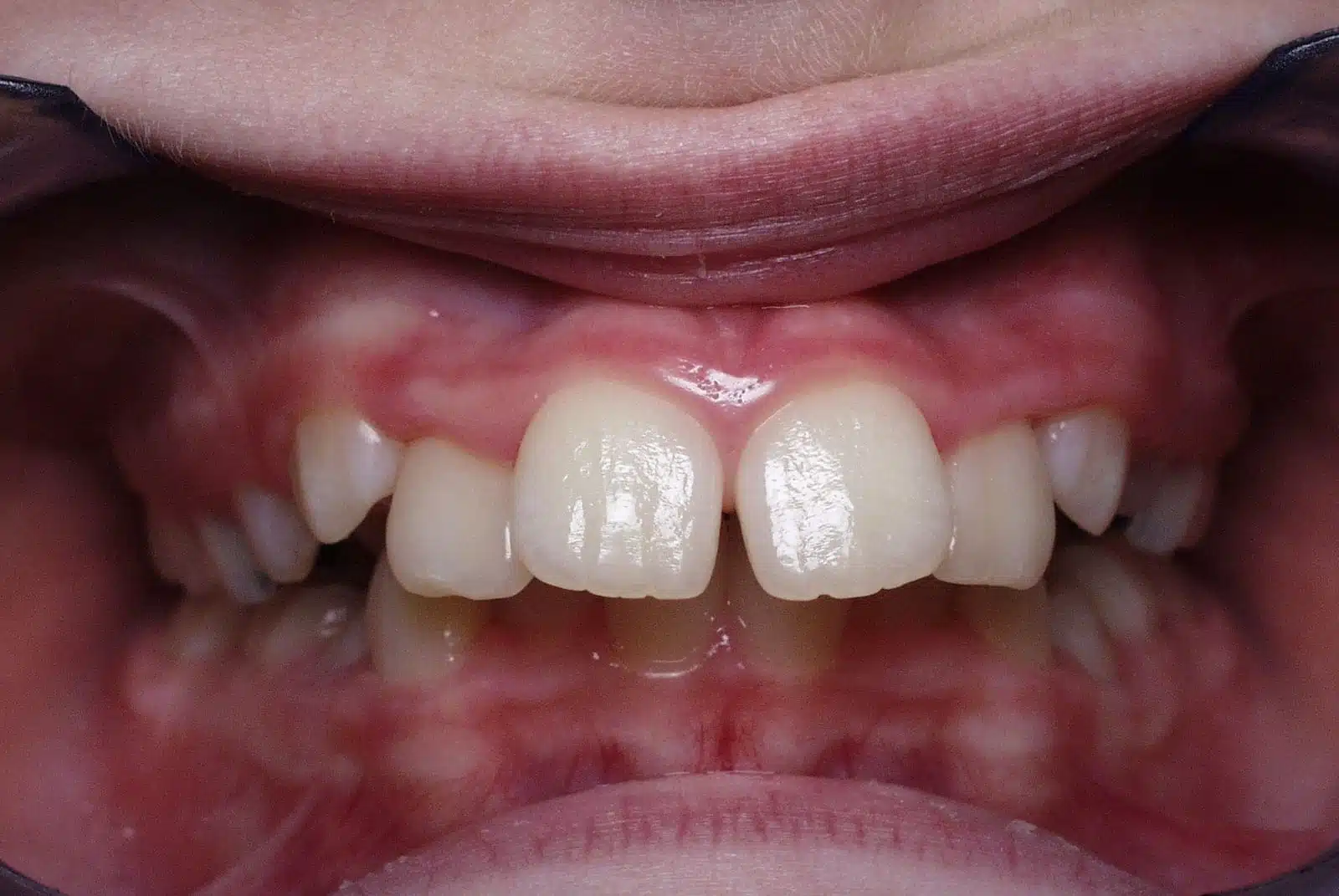 GC 2 pretx GC 2 pretx