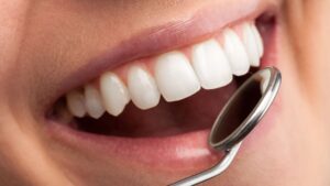Straighten Your Smile with a Greenwich Orthodontist
